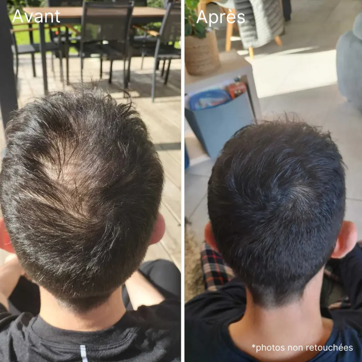 Crème capillaire PalmHair® - Effet densité immédiat