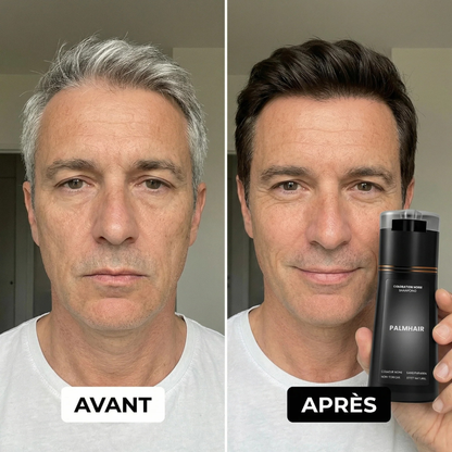 Box Anti-Cheveux Blancs – Édition Limitée