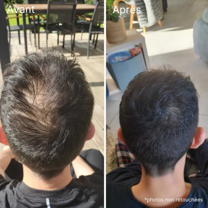 Crème capillaire PalmHair® - Effet densité immédiat