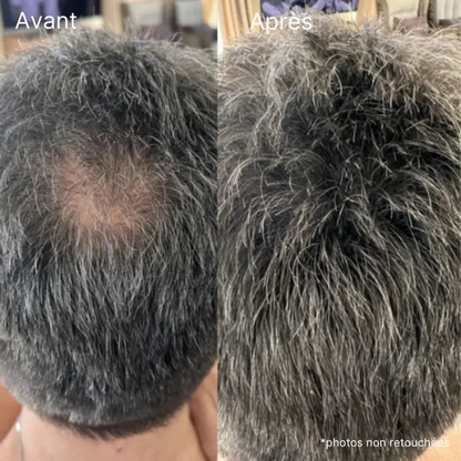 Crème capillaire PalmHair® - Effet densité immédiat